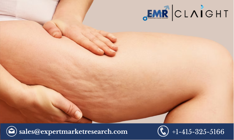 Cellulite Treatment Market